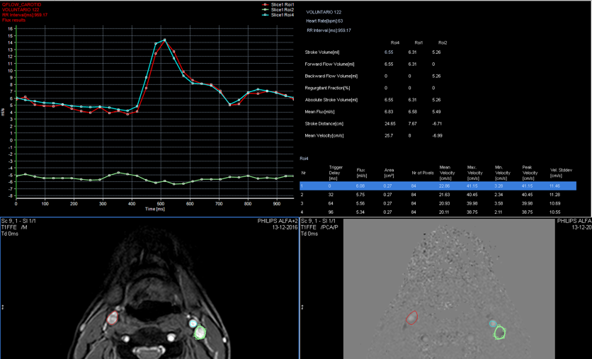 resonancia magnetica cerebral dinamicas